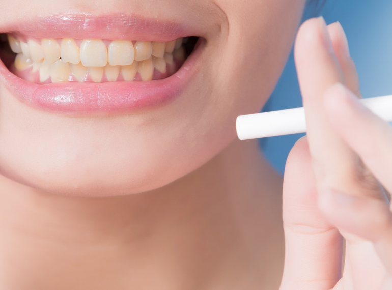 roken en mondgezondheid